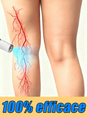 Pointeur laser portable pour le soin des jambes