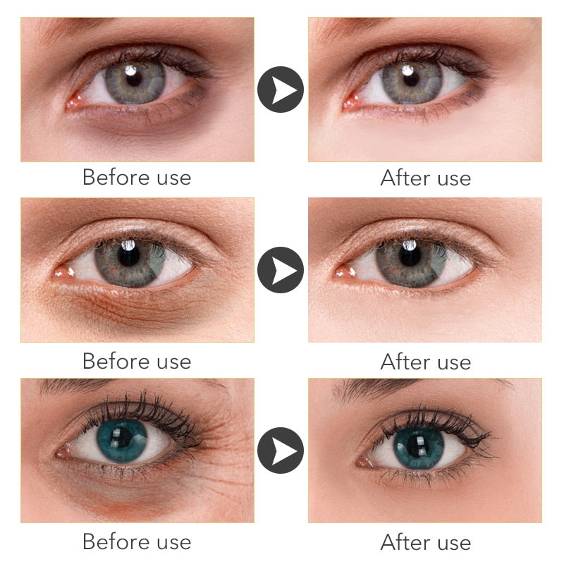 Crème contour des yeux au rétinol – Anti-poches, cernes et rides